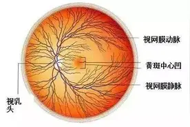 心梗、脑梗之后眼梗也来了！眼科专家提醒：无痛性视力骤降要立即就诊图片