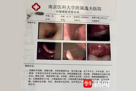 每次扁桃体发炎，血尿也会加重！医生：这种情况下切除扁桃体“更划算”图片