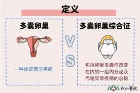 突然变胖、喝凉水都长肉？松山医院：警惕多囊卵巢综合征图片