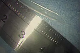 外卖餐盒碎片溜进男子胃中，专家提醒：开外卖盒时多加注意图片