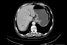 医生、患者与豫剧的故事｜有医说医图片