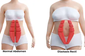 女子分娩后“门板”大开，肠子内脏全露出！医生：大多数产妇或多或少都有图片