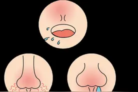 鼻子为何老是堵？原因和应对方法看过来图片