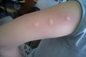 咸宁今年蚊子多？真相是…图片