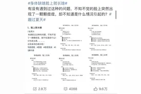 额头长痘心火旺？腮边长痘肝受累？ 长痘真的代表内脏出问题了？图片