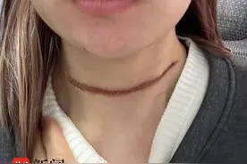女生参赛被风筝线“割喉”！组委会签了《免责协议》就能免责吗？图片