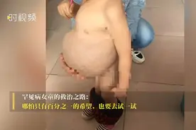 罕见病女童的救治之路：哪怕只有1%的希望，也要去试一试图片