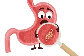 患了慢性胃炎，应该怎么吃？图片