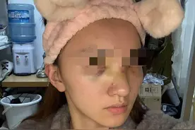 成都一女子在室内潮玩馆发生意外 坠落海绵堆致面部多处骨折｜追踪到底图片