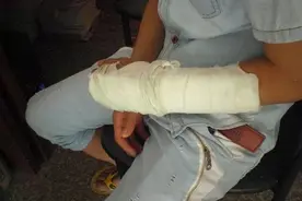 手机爆炸致夫妻重伤、儿女双亡！用手机千万别犯4个错，爆炸前4个信号人人必知图片