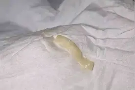 19岁男大学生腹泻上完厕所回头一看慌了：里面竟有一条虫......图片