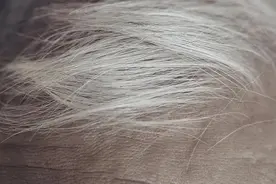 白发长在哪，病就从哪来吗？这3处尤其要注意图片