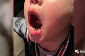 花16600元送儿子去学钢琴，却被打掉一颗牙！培训老师：正常教学图片