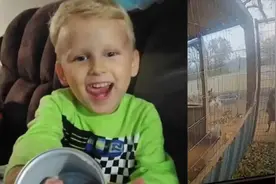 4岁男孩在伸手抚摸斗牛犬幼犬时 被撕扯掉整只手臂图片