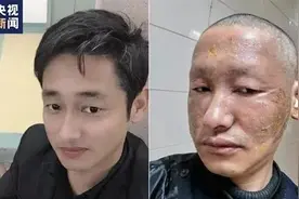 全网心疼的对比照，更新了图片