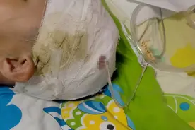 河南小学生被校长拍打头部后病发，校长是否需赔偿引纠纷图片