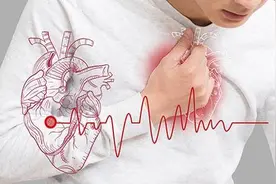 心脑血管疾病高发期 这些症状要警惕图片