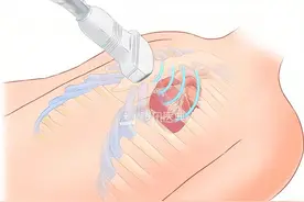 心脏彩超科普小知识图片