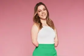 18岁励志女孩失去四肢 兼职做美妆博主获千万粉丝图片