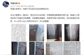 “右大腿骨折后骨头一直消失”，女生自述患罕见病多年无法找到病因图片