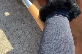 女子进滑雪场还没滑雪就摔成骨折，医生提醒：避免受伤应注意以下5点图片