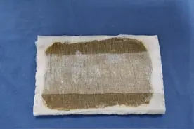 脚踝扭伤了？这个火了上百年的药膏或许能帮到你图片