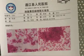 父亲患癌，女儿辞职还乡为父治病无奈求助：妈妈早年离世，不想爸爸也离开图片