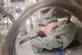 95后产妇早产1女4男5胞胎 体重最重的1.4公斤图片