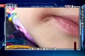 比久坐更伤身！7个常见坏习惯，你可能每天都在做！图片