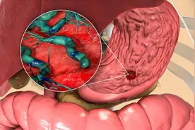 胃最怕你做3件事，沾一个胃烂一分、胃癌近一步！再不注意，铁打的胃也扛不住图片