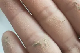 上游帮忙 | 家中出现大量不明黄色粉末，究竟是啥？图片