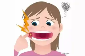 口腔黏膜炎怎么缓解呢？图片