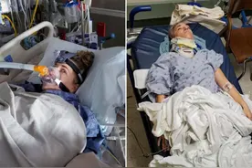 美国跳伞者被降落伞缠住腿 高速坠地后奇迹般幸存图片