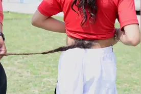 尼泊尔16岁男孩拥有70厘米长“尾巴”！在社交媒体上走红图片