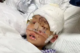 晨意帮忙丨收废品大爷砸灭火器致4岁男童重伤！急需爱心救助图片