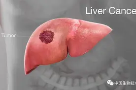 癌症治疗又见曙光！7分钟体外无痛根除肝癌患者肿瘤！大鼠实验证实治疗后无转移、无复发，提高生存率图片