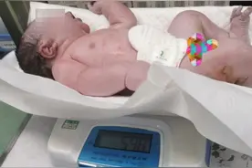 11.96斤！一巨型婴儿降生，分娩过程惊心动魄！医生揭露原因图片