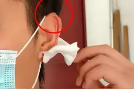 西安一小伙去理发，没想到左耳被剪掉一块肉……医院：已造成不可逆损伤图片