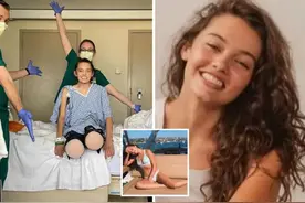 美女模特失去双腿，年初感染新冠差点丧命只好截肢，如今坚强生活图片