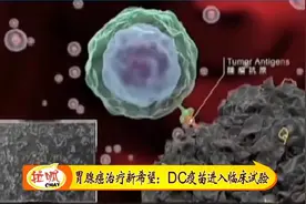 治疗胃腺癌新希望！DC疫苗进入临床试验，每位受试者治疗两个疗程