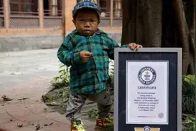 尼泊尔18岁男子身高73.43厘米 获吉尼斯世界纪录图片