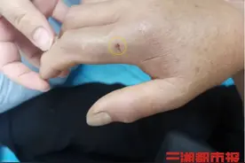 机智！湖南一大妈被毒蛇咬伤 开启“教科书式”自救图片