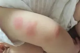 夏日驱蚊虫除蟑螂的小窍门，90%人却不知道图片