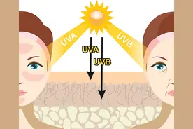 夏日炎炎说祛斑，内服外治怎么选？图片