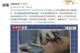 牙齿是越白越好吗？淡黄色的牙齿才更健康图片