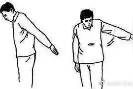 肩周炎出现哪种情况需要治疗？图片