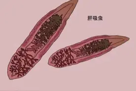 生食一时爽，后果不敢想图片