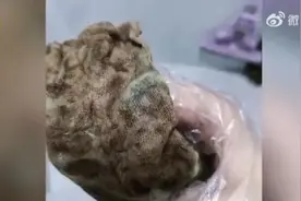 女子产后体内遗留纱布！当地卫健委回应：助产士失误，已被暂停执业图片