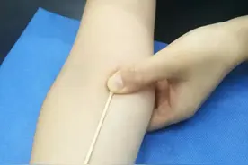 抽血后按压不当胳膊一片淤青？来学正确按压手法图片