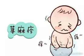 急性和慢性荨麻疹有明显区别 很多人分不清图片